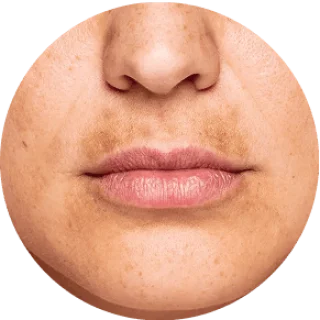GloraMD Face Lift Serum