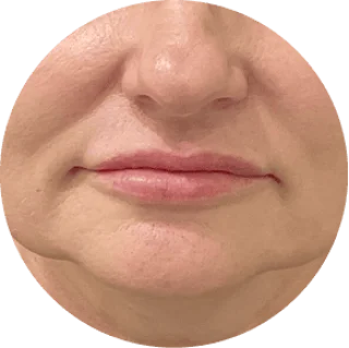 GloraMD Face Lift Serum